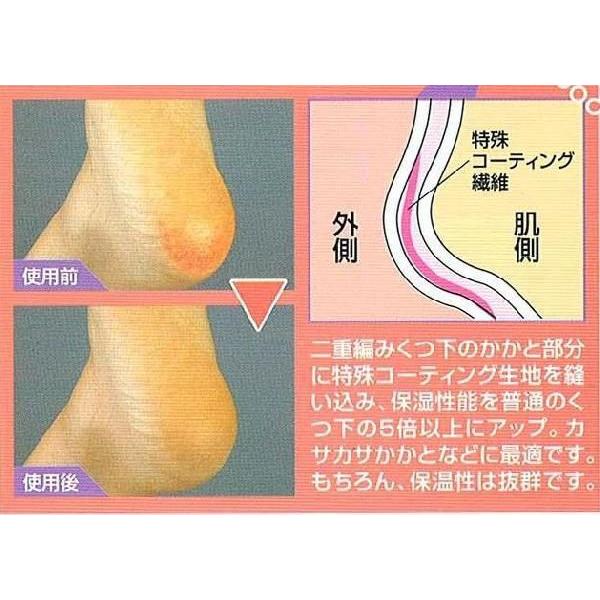 �V ���₷�� �G�X�e ������ ��� �C�� �V���₷�݃G�X�e �ێ� �J�T�J�T �ێ����\ ��d�҂� ������ �C�� �\�b�N�X ���{�� ���[���� �|�X�g���� ���i�摜1