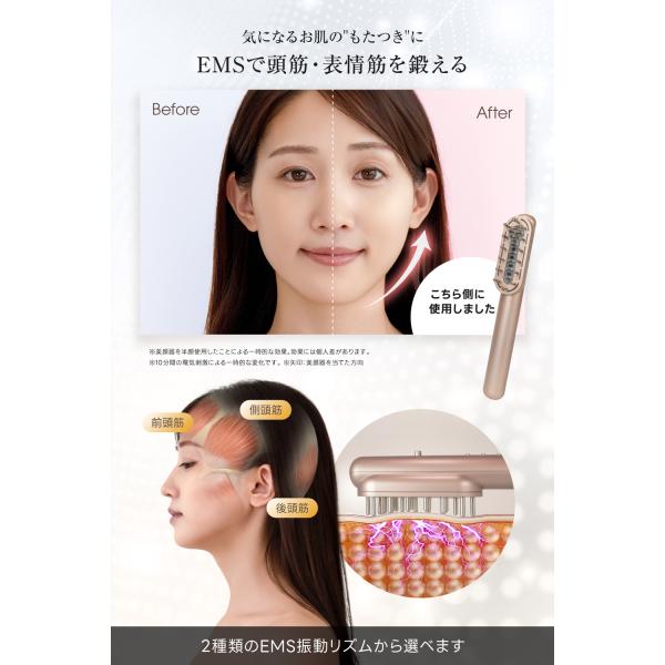 excitech_relx-elecbrush-001_3_d_20251201200832