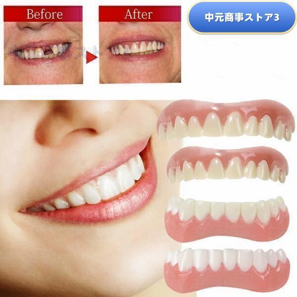 寸法すんぽう：5*2cm【重量】（約） 4ｇ【材質】 熱可塑性プラスティック※フィッティングはリセット可能ですのでやり直し出来ます。 ※上歯用は本体裏側に特製具材がセットされていますので、ワンタッチでフィッティングできます。 ※下歯用は別途...