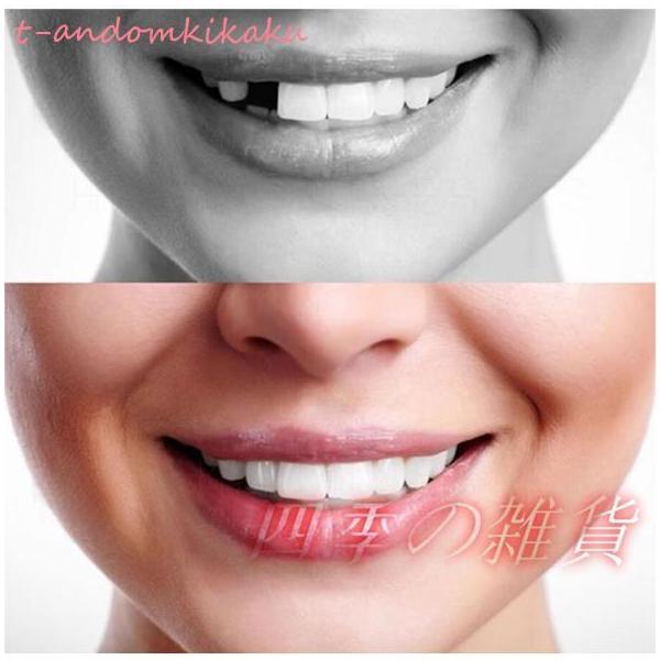 義歯 仮歯 3色セット 抜け歯 欠け歯 つけ歯 差し歯 入れ歯