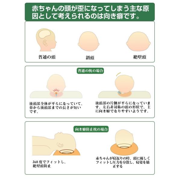 Adokoo ベビーまくら 向き癖防止枕 絶壁頭 斜頭 変形 猫背 寝姿を矯 正 頭の形が良くなる 男女兼用 汗とり 快眠 低反発ピロー 綿 Prettyfunnyballoons Com