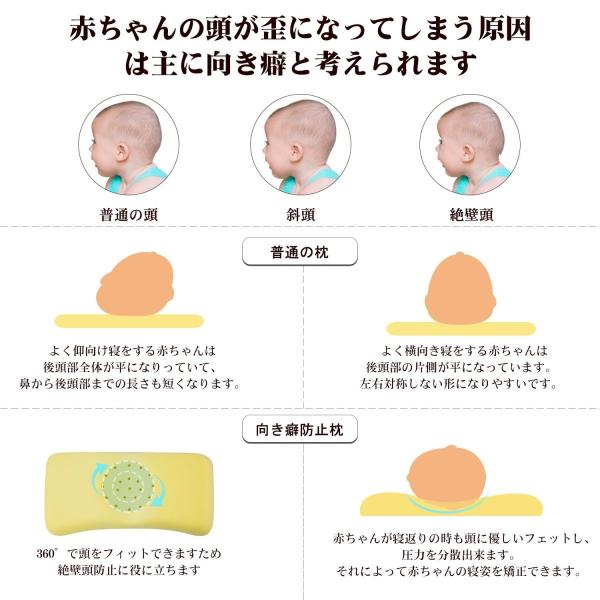 Mofir ベビーまくら ベビー枕 こども用枕 赤ちゃん枕 通気まくら ドーナツ枕 低反発ピロー 夜泣き 向き癖防止枕 むきぐせ防止クッショ Www Donabeija Pt