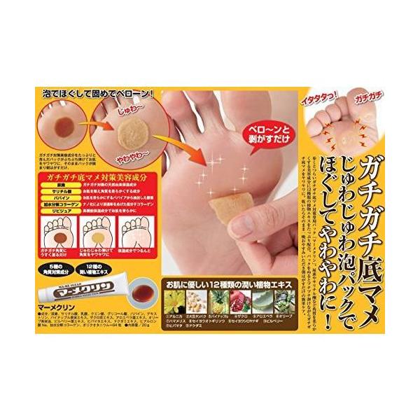 マーメクリン 20ｇ 足 底マメ 足裏 まめ 足裏パック 泡パック クリーム 泡パック ボディケア 美容成分配合 角質ケア 角質除去 ガサガサ　送料無料