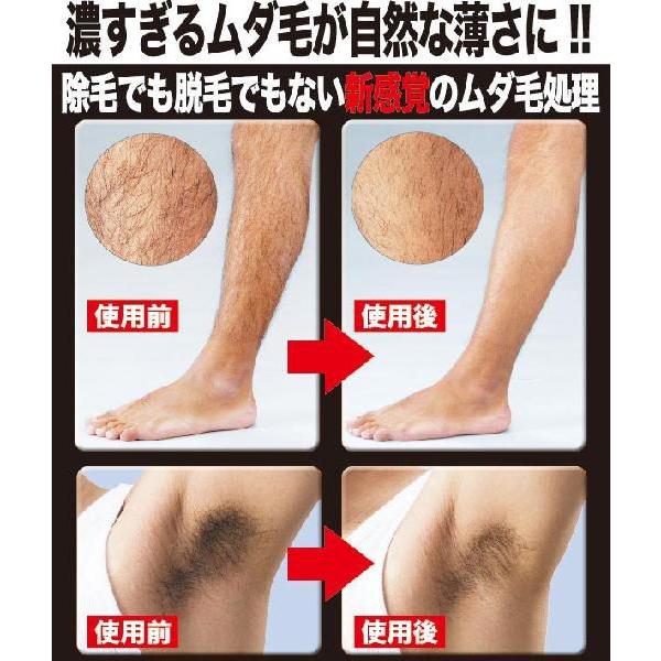 ムダ毛ジョリー メール便送料無料 胸毛 腕毛 スネ毛 梳く 薄くする すね毛 カミソリ 処理 Buyee 日本代购平台 产品购物网站大全 Buyee一站式代购 Bot Online