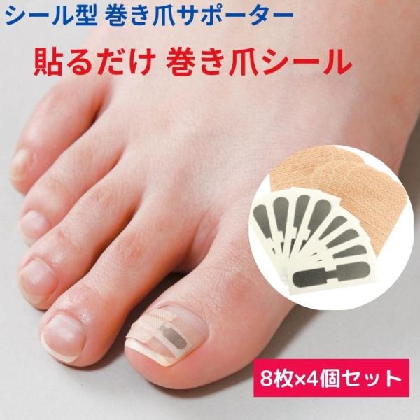 巻き爪 矯正 - その他の矯正グッズの人気商品・通販・価格比較 - 価格.com 巻き爪 矯正 - その他の矯正グッズの人気商品・通販・価格比較 - 価格.com