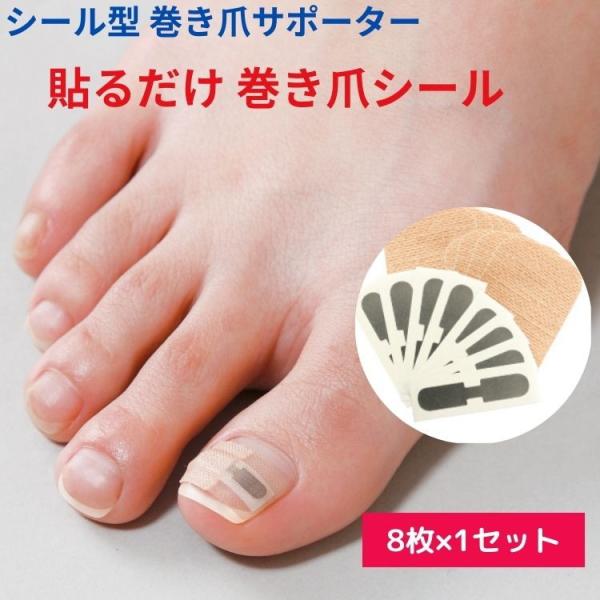 ❥新品未使用❥巻き爪用ジェル❥formegel❥巻き爪シール付 Amazon | 簡単塗るだけ巻き爪ケアジェル/フォルムジェル