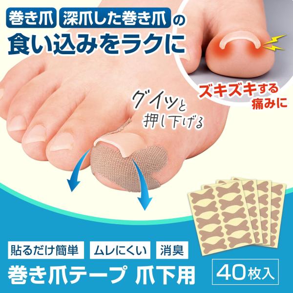 ＼つらい巻き爪をケア／・巻き爪をケアするためのテープです。・巻き爪が皮膚に食い込んでくる部分を引っ張ることで食い込む痛みを軽減します◎・深爪した巻き爪にも使える2way仕様！・縦に伸びやすく皮膚にフィットし、横に伸びにくくしっかりサポートし...