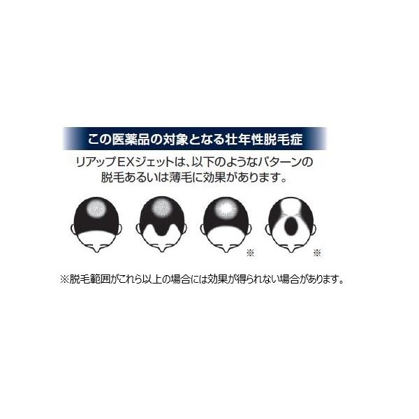 大得価人気 リアップexジェット T 富士薬品paypayモール店 通販 Paypayモール 100ml 2個セット 要メール返信 薬剤師からのメールをご確認ください 通販高評価 Hualing Ge