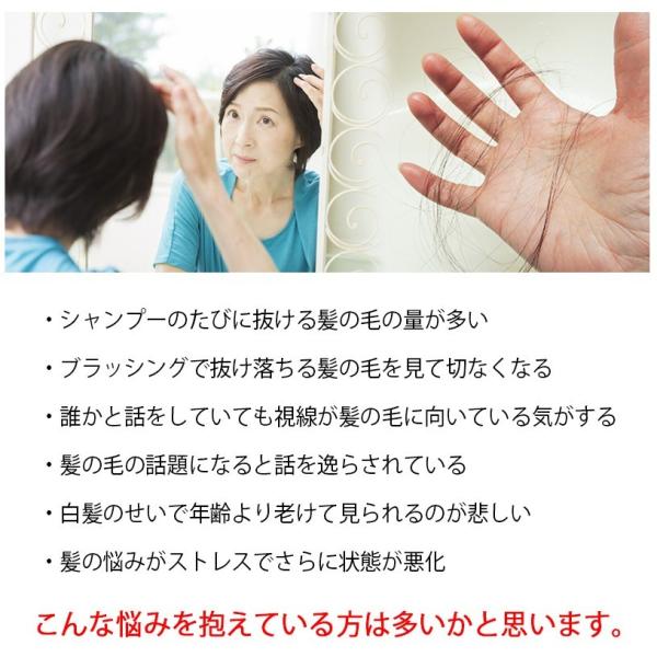 ノコギリヤシ フッサ21 Fussa21 育毛 白髪 薄毛 髪 髪の毛 スカルプ サプリ サプリメント 60粒 男性 女性 イソフラボン 育毛 剤発毛剤ではなくサプリ Buyee Servicio De Proxy Japones Buyee Compra En Japon