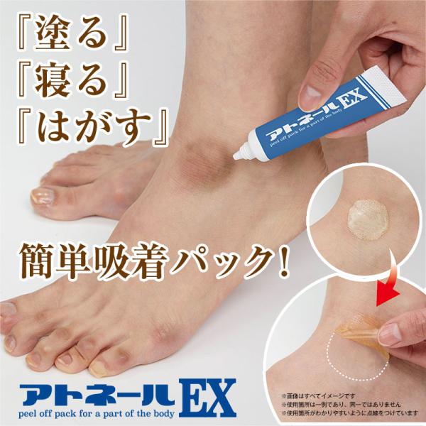 アトネールEX 15g くるぶし かかと 茶アトケア フットケア 色素沈着 日本製 靴擦れ 古い角質 ラベンダーの香り アルブチン プラセンタ 足の指 角質硬化 角質ケア