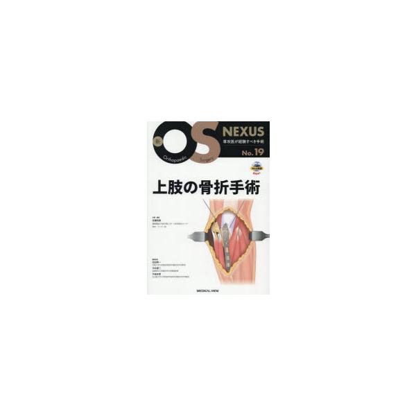 上肢の骨折手術 : ぐるぐる王国2号館 ヤフー店 - 通販 - Yahoo