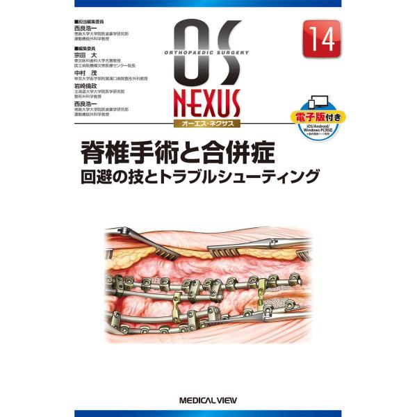 脊椎手術と合併症 回避の技とトラブルシューティング 脊椎手術と合併症 回避の技とトラブルシューティング (OS NEXUS(電子版