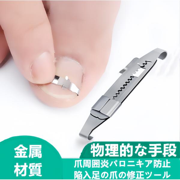 巻き爪ケアクリップ ワイヤー ガード 爪ブロック テープ 巻きづめ 治し方 矯正 テープ 巻きづめ 靴 巻爪 対策 足の巻き爪 防止 :tumecyousei:アキ - 通販 - Yahoo!ショッピング 巻き爪ケアクリップ ワイヤー ガード 爪ブロック テープ 巻きづめ 治し方 矯正 テープ 巻きづめ 靴 巻爪 対策 足の巻き爪 防止 :tumecyousei:アキ - 通販 - Yahoo!ショッピング