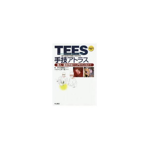 ＴＥＥＳ（経外耳道的内視鏡下耳科手術）手技アトラス TEES(経外耳道的内視鏡下耳科手術)手技アトラス | 欠畑誠治