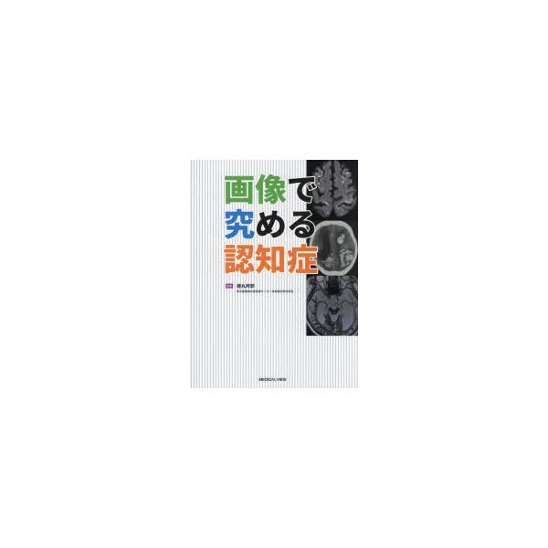 画像で究める認知症 : ぐるぐる王国 ヤフー店 - 通販 - Yahoo!ショッピング