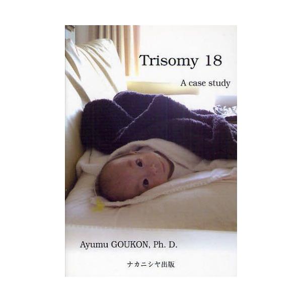 Trisomy18 A case study