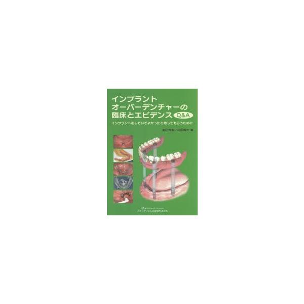 ☆裁断済 インプラントオーバーデンチャーの臨床とエビデンス Q&A インプラントオーバーデンチャーの臨床とエビデンスQ＆A