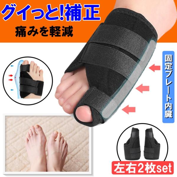 左右ペアセットです。装着は室内で就寝時での使用をお勧めします。【商品のポイント】　〇プレート内臓により親指の側面をしっかりと固定し正しい位置に戻すことで　　痛みの緩和や悪化を防ぐ効果が期待できます。　〇マジックテープでお好きな締め具合に調整...