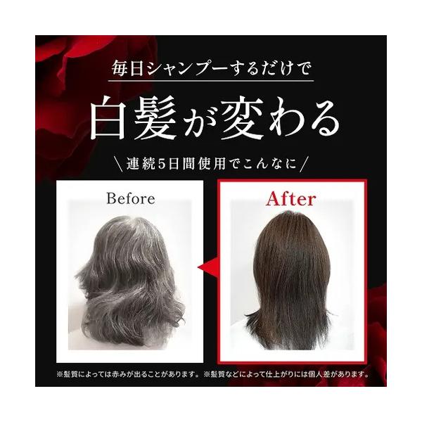 hands-net_4560253331734_2_d_20251207111549