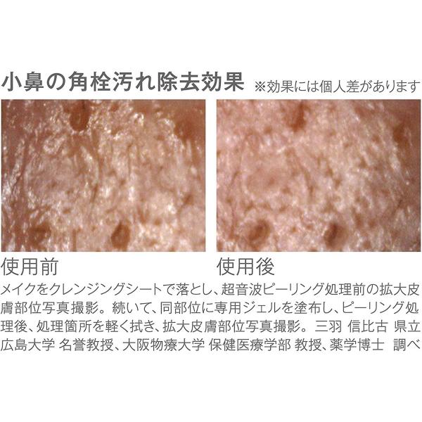 コイズミ 超音波 ピーリング 皮脂 角栓汚れ除去 ピンク Kbe 2700 P Prettyfunnyballoons Com