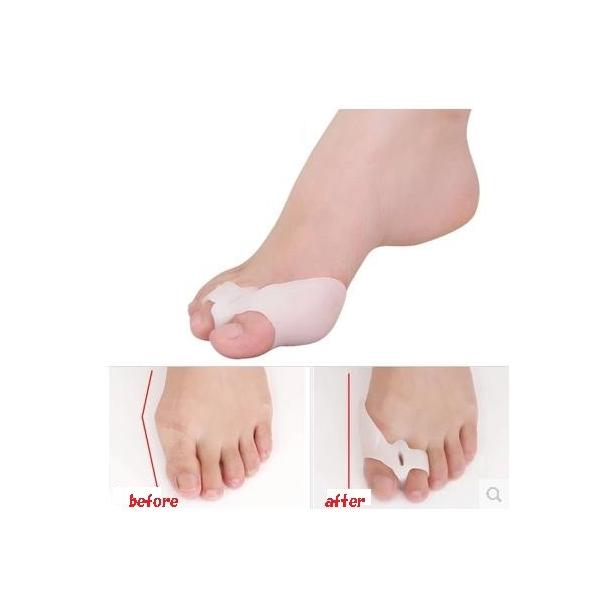 外反母趾を矯正するシリコンゴム外反母趾の痛みを軽減 Buyee Buyee 提供一站式最全面最專業現地yahoo Japan拍賣代bid代拍代購服務bot Online