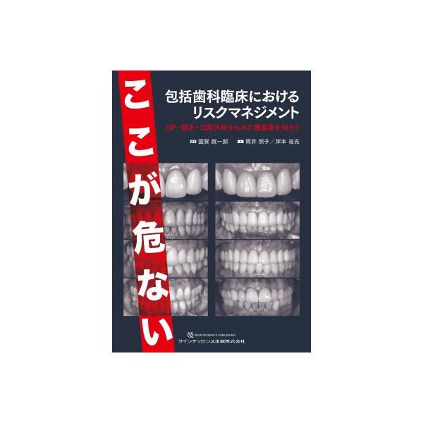 ここが危ない 包括歯科臨床におけるリスクマネジメント GP・矯正・口腔外科からみた難易度を知ろう / 国賀就