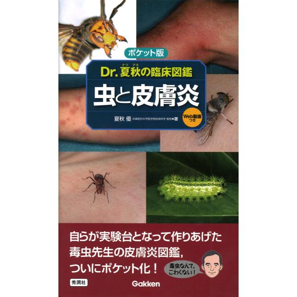 ポケット版 虫と皮膚炎/夏秋優 : Honya Club.com Yahoo!店 - 通販