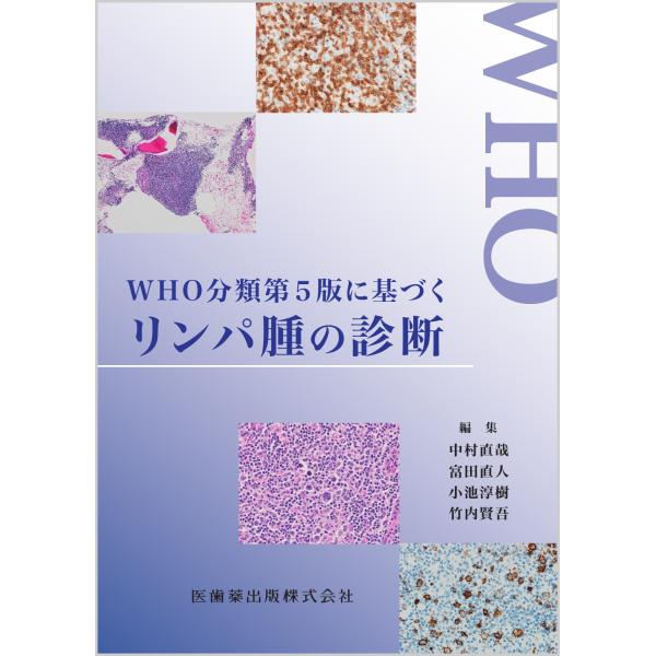 出版社名：医歯薬出版著者名：中村直哉、富田直人、小池淳樹発行年月：2026年01月キーワード：ダブリューエイチオー ブンルイ ダイ ゴハン ニ モトズク リンパシュ ノ シンダン、ナカムラ,ナオヤ、トミタ,ナオト、コイケ,ジュンキ