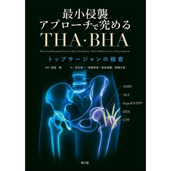 翌日発送・最小侵襲アプローチで究めるＴＨＡ・ＢＨＡ/西脇徹