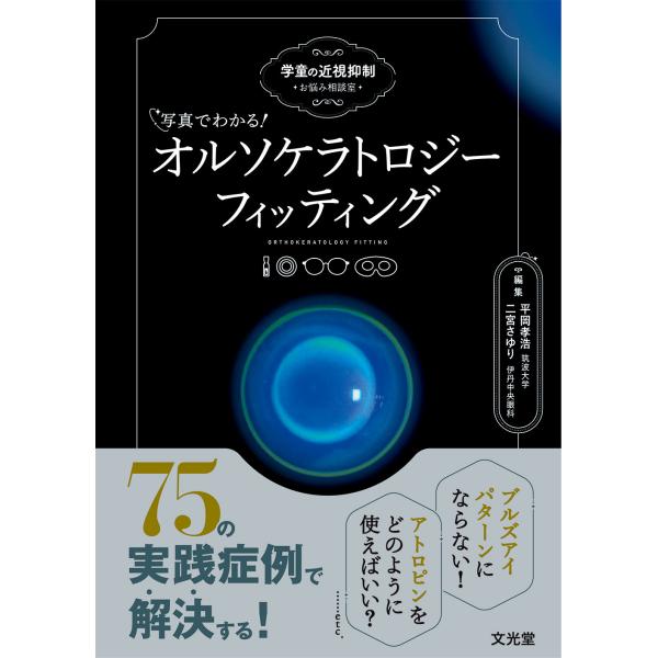 出版社名：文光堂著者名：平岡孝浩、二宮さゆり発行年月：2025年10月キーワード：シャシン デ ワカル オルソケラトロジー フィッティング、ヒラオカ,タカヒロ、ニノミヤ,サユリ