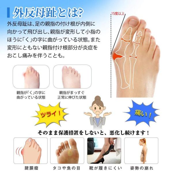 外反母趾サポーターソフトサポーター親指矯正グッズシリコンジェルパッド Buyee 日本代购平台 产品购物网站大全 Buyee一站式代购bot Online