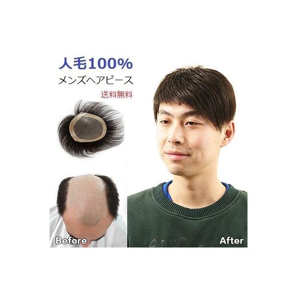 21 23cm 選べる大きさ メンズ ヘアピース エクステ かつら 男性 自由 頭頂部 人毛 人工頭皮 Rh03 Buyee Buyee Japanese Proxy Service Buy From Japan Bot Online