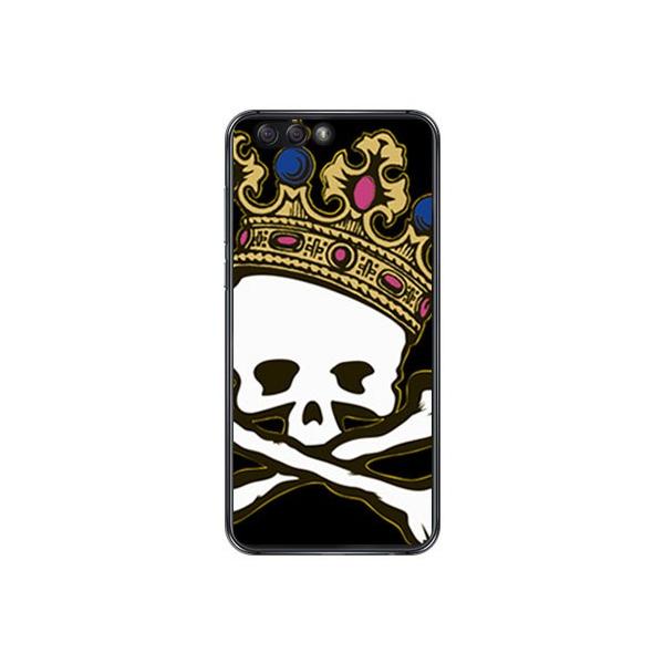 ZenFone 4 �P�[�X ZE554KL �X�J���L���O TYPE2 �X�}�z�P�[�X (�󒍐��Y)