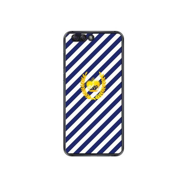 ZenFone 4 �P�[�X ZE554KL �X�g���C�v �u���[×�z���C�g �X�}�z�P�[�X (�󒍐��Y)