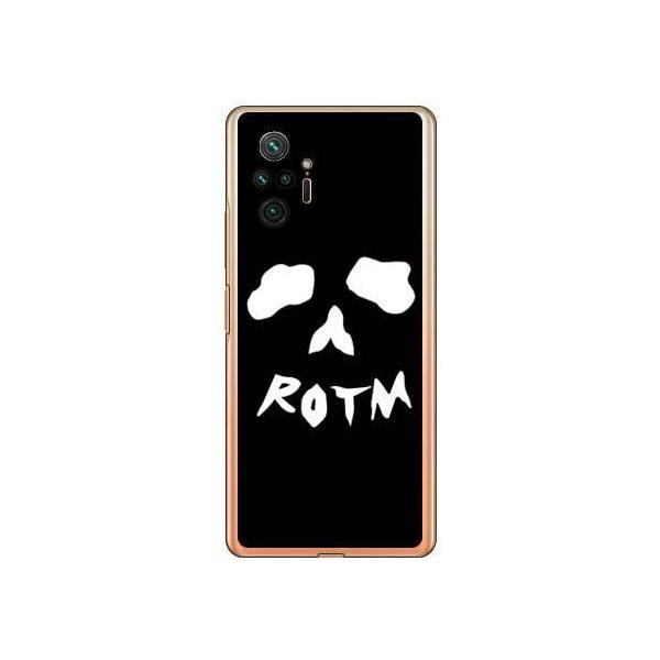 Redmi Note 10 Pro �P�[�X Face bone �u���b�N �X�}�z�P�[�X (�󒍐��Y)