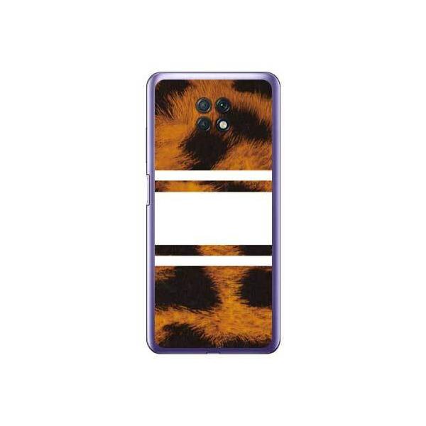 Redmi Note 9T (A001XM) Leopard �z���C�g �X�}�z�P�[�X (�󒍐��Y)