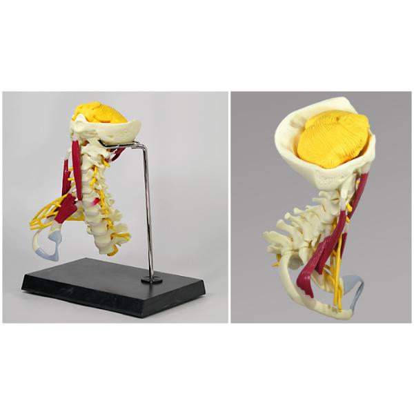 人体模型　頚椎/デラックス型・筋付き　日本語訳付き　GPI Anatomicals