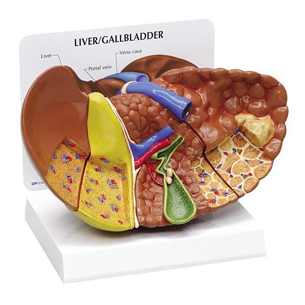 人体模型 肝臓と諸疾患 日本語訳付き GPI Anatomicals : 人体百科