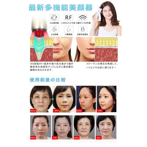 Rfラジオ波 遠赤外線美顔機 家庭用rfラジオ波高周波 美顔器 フェイスライン引き締め リフトアップ セルライト痩身に効く Buyee Buyee 提供一站式最全面最专业现地yahoo Japan拍卖代bid代拍代购服务 Bot Online