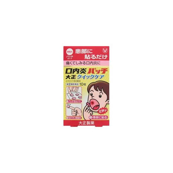 在庫状況：在庫あり/★携帯電話でご覧の方はPC版説明文又は全文を読むをご確認ください/キーワード:口内炎(アフタ性)(口内炎(アフタ性))とは・・・頬の内側や舌、唇の裏側などに、周りが赤っぽく、中央部が浅くくぼんだ白っぽい円形の痛みを伴う浅...