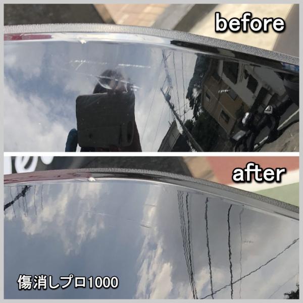 マイエターナル 傷消しプロ1000 Buyee Buyee Japanese Proxy Service Buy From Japan Bot Online