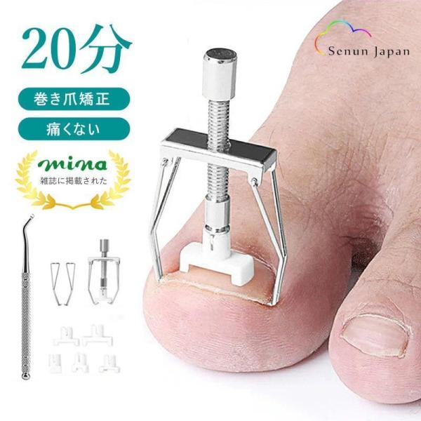 巻き爪矯正 セット 自分で 20分だけ 治療 爪切り 巻き爪クリップ ワイヤー ネイルエイド 陥入爪 巻き爪 ネイル 矯正グッズ 自宅で矯正 補正