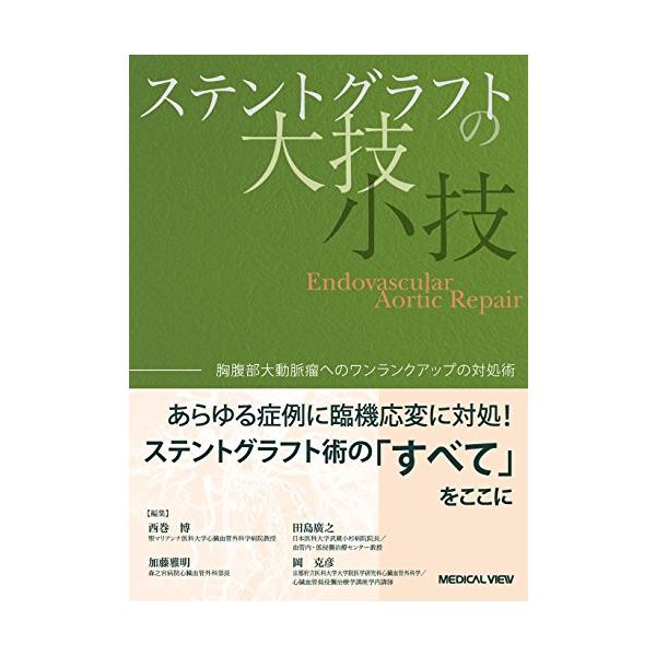 ステントグラフトの大技・小技−胸腹部大動脈瘤へのワンランクアップの対処術