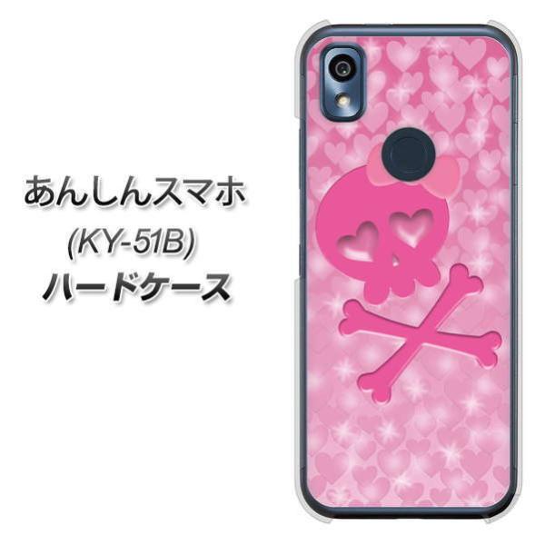 ���񂵂�X�}�z KY-51B �n�[�h�P�[�X �J�o�[ VA907 �n�[�g�̃h�N�� �f�ރN���A UV���