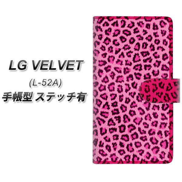 LG �x���x�b�g L-52A �蒠�^ �X�}�z�P�[�X �y�X�e�b�`�^�C�v�z 1066 �q���E���x�[�V�b�NS �s���N UV��� ���J��