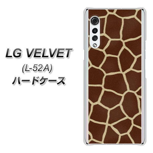 LG �x���x�b�g L-52A �n�[�h�P�[�X �J�o�[ 209 �L�����̔w�� �f�ރN���A UV���