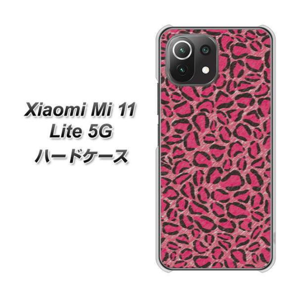 �V���I�~ Mi 11 Lite 5G �n�[�h�P�[�X �J�o�[ VA894 �f�U�C���q���E�� �s���N �f�ރN���A UV���