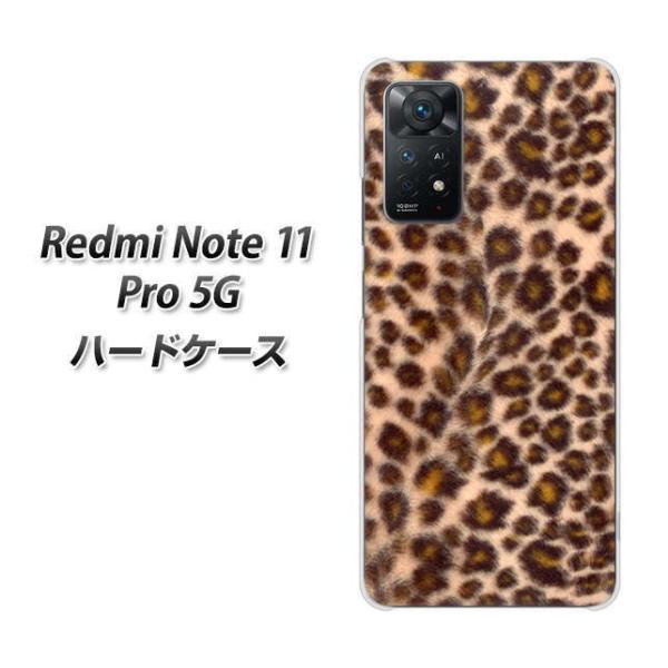 SIM�t���[ Xiaomi Redmi Note 11 Pro 5G �n�[�h�P�[�X 068 �q���E�� �f�ރN���A UV���