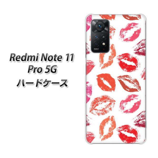 SIM�t���[ Xiaomi Redmi Note 11 Pro 5G �n�[�h�P�[�X 734 �L�Xkiss�L�X �f�ރN���A UV���
