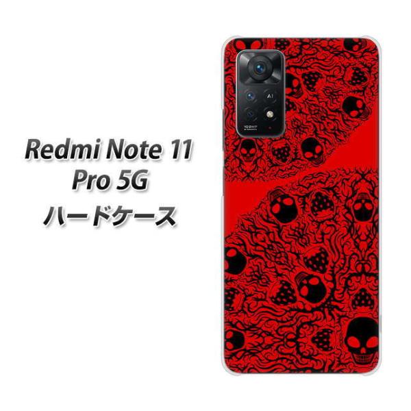 SIM�t���[ Xiaomi Redmi Note 11 Pro 5G �n�[�h�P�[�X AG835 䕊[����䶗�(��) �f�ރN���A UV���